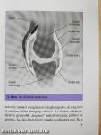 Reumatoid artritisz