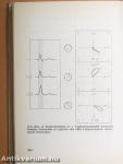 Electrocardiologia az orvosi gyakorlatban