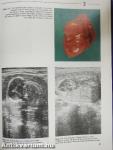 Atlas of Fetal Diagnosis