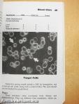Silent Clots