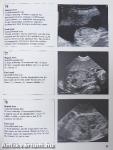 Szülészeti-nőgyógyászati ultrahang-diagnosztika Atlasz