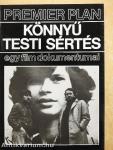 Könnyű testi sértés
