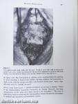 Application of Lasers in Neurosurgery