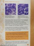 Lymphoma Classification