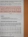 EKG alapismeretek