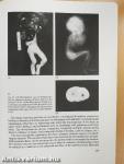 Obstetric Genetics