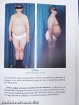 Metabolicus syndroma