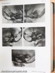 Lehrbuch der Röntgendiagnostik