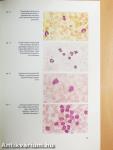 Hematological Laboratory Methods