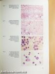 Hematological Laboratory Methods