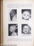 Dysenteria