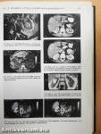 Nephrologia