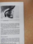 Gastrointestinalis endoscopia