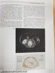 Hutchison's Clinical Methods