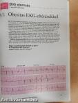 EKG esetismertetések