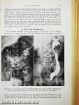 Malformations