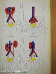Malformations