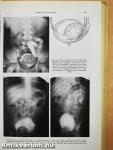 Malformations