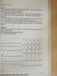 EKG atlasz