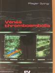 Vénás thromboembolia