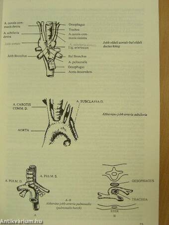 Gyermekpulmonológia