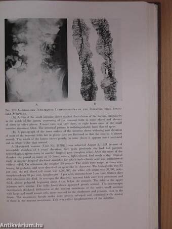 Radiologic Examination of the Small Intestine