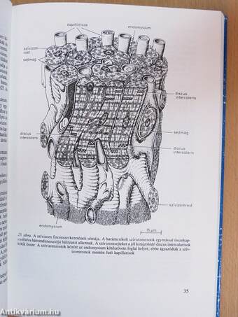 Az isémiás szívbetegség funkcionális patológiája