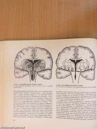 Fejlődésneurológia, neurohabilitáció