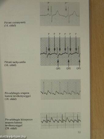 EKG a sürgősségi ellátásban