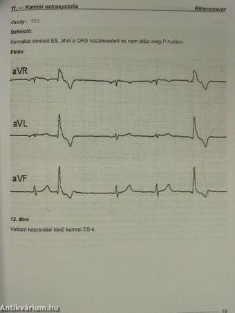 EKG súgó - CD-vel