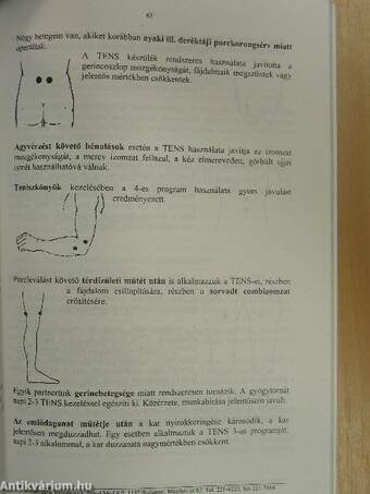 Ajánlások az SE-30 TENS hatékony felhasználásához