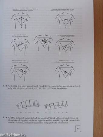 Ami az EKG könyvekből kimarad...