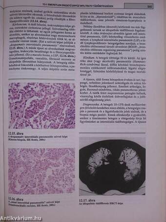 Pulmonológia