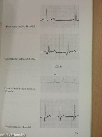 EKG a sürgősségi ellátásban