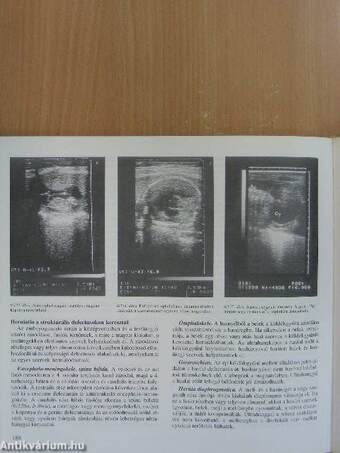 Szülészet-nőgyógyászat 1-3.