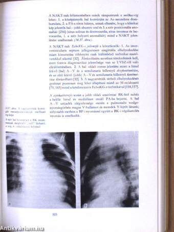 A veleszületett szívbetegségek klinikopatológiája