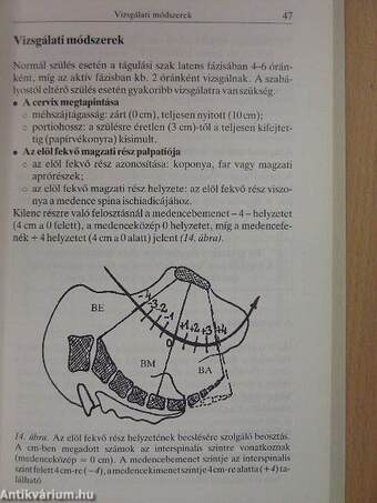 Gyakorlati szülészeti ismeretek