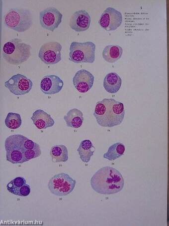 Atlas de klinischen Hämatologie und Cytologie I-II.