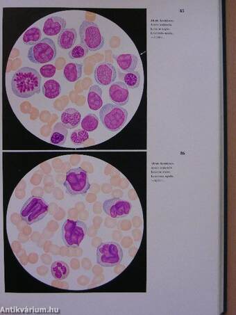 Atlas de klinischen Hämatologie und Cytologie I-II.