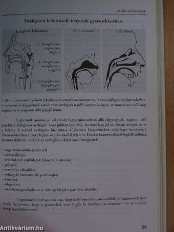 Gyermek fül-orr-gégészeti útmutató háziorvosoknak