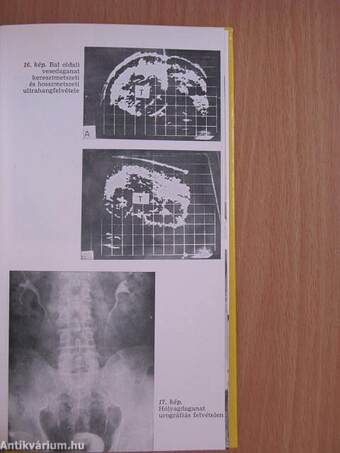 Az urológia válogatott fejezetei (diagnosztika)