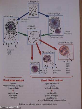 Allergiás Rhinitis