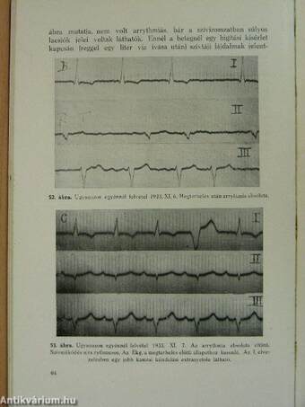 Elektrokardiographia