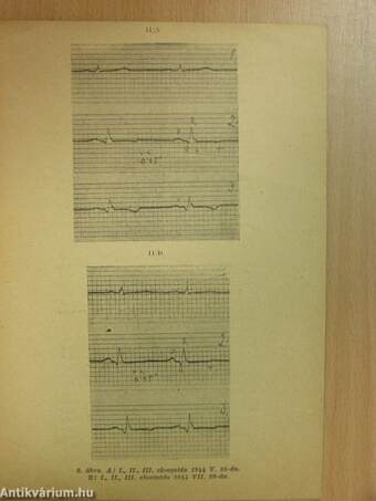 Az angina pectoris és myodegeneratio cordis uj gyógymódja