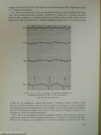 A szív elektromos működésének vizsgálata