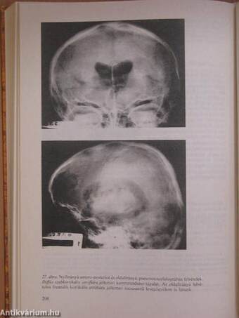 Neurológia, neuropszichológia