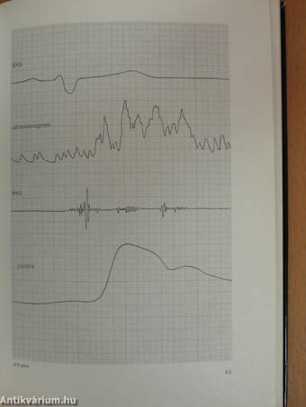 Cardiomyopathia