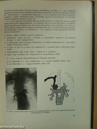 A mediastinum betegségei