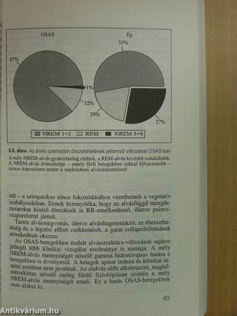 Az obstruktív alvási apnoe szindróma