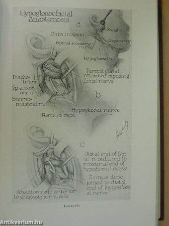 Modern Surgical Technic II.